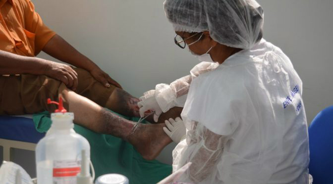 Com média de 500 paciente ao mês, setor de Feridas é destaque do HRMS Com média de 500 paciente ao mês, setor de Feridas é destaque do HRMS