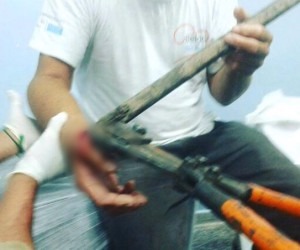 Gancho atravessa mão de vigilante que tentava espantar pássaros Bombeiros foram acionados para realizar procedimento - Reprodução/Diário Corumbaense