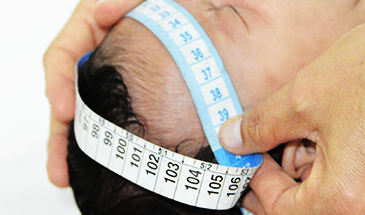 Vírus bovino é encontrado em tecidos de bebês com microcefalia Vírus bovino é encontrado em tecidos de bebês com microcefalia