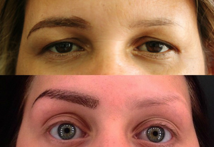 Já ouviu falar em prótese de sobrancelha? Antes e depois da aplicação... (Foto: Reprodução Instagram)