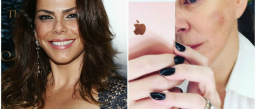 "Ele me machucou demais", diz atriz Gisele Fraga sobre agressão © Reprodução