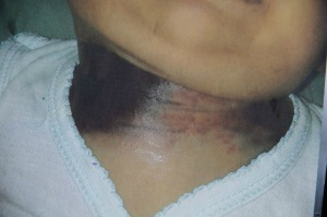 Bebê morre e família acusa enfermeiros do Hospital Regional de negligência