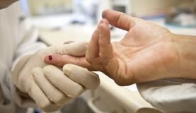 Menos da metade dos infectados por HIV e tuberculose tomam antirretroviral Diagóstico precoce do vírus HIV e o início do tratamento é considerado o método mais eficaz de prevenir mortes por aids e causas associadasArquivo/Agência Brasil
