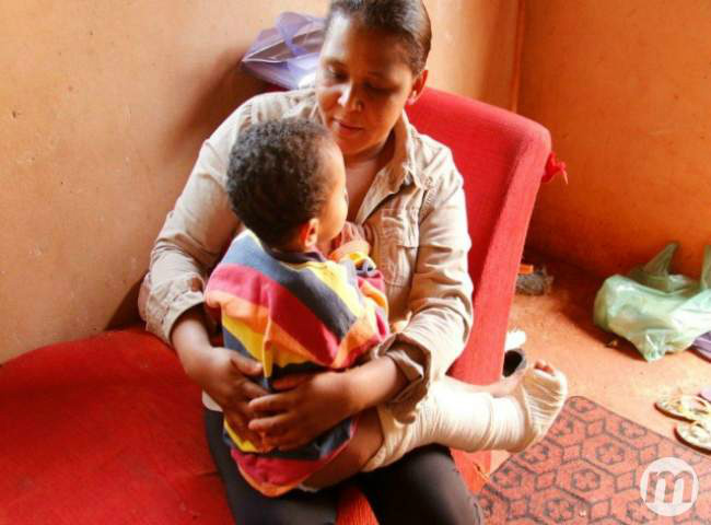 Menino pode ficar com uma perna menor que a outra por conta da fratura (Foto: Cleber Gellio/Midiamax)