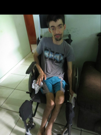 Homem tem doença rara e esperança de família é tratamento no Paraguai Almir Rogério descobriu a doença há 15 anos e necessita de ajuda para o tratamento (Foto: Rodrigo Bossolani)