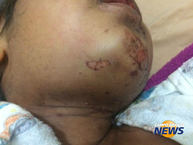 Foto: Direto das Ruas)