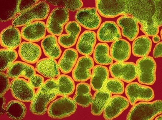 Novo medicamento poderia fazer idoso de 90 anos ter o sistema imunológico de alguém de 20 Novo medicamento poderia fazer idoso de 90 anos ter o sistema imunológico de alguém de 20