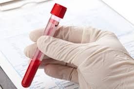 Hemorio inicia testes com plasma sanguíneo no tratamento de covid-19 Divulgação