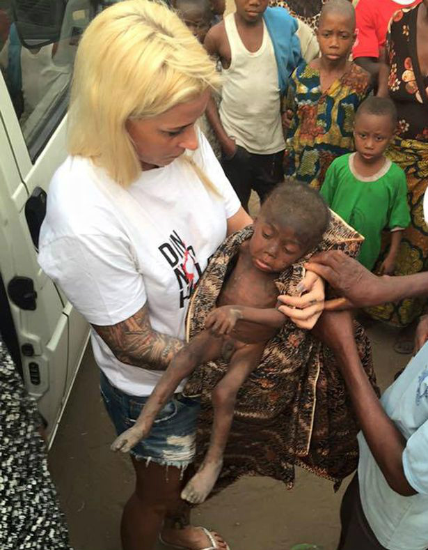 Garoto de 2 anos é encontrado desnutrido após família o abandonar por acreditar que ele era bruxo