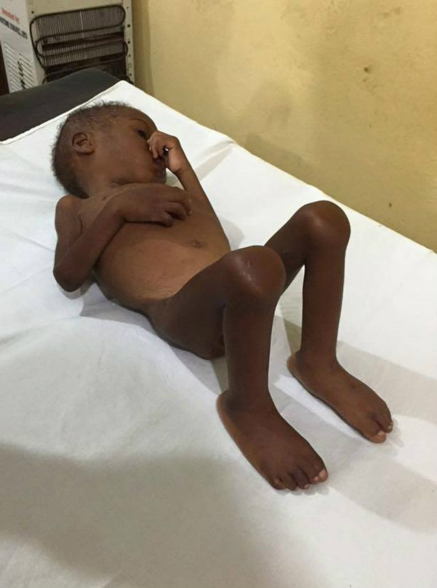 Garoto de 2 anos é encontrado desnutrido após família o abandonar por acreditar que ele era bruxo