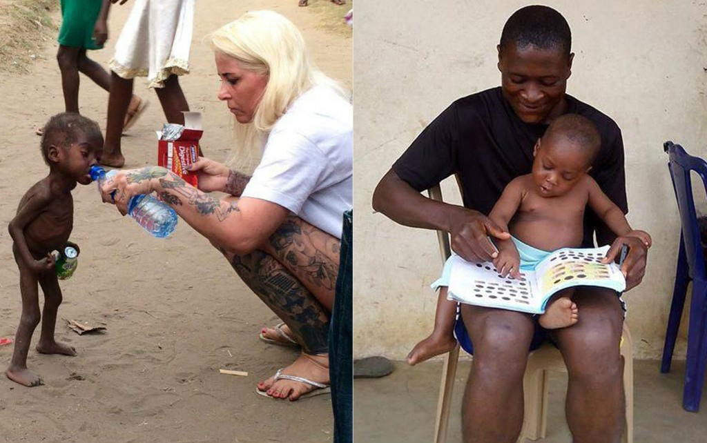 Hoje, ele é uma criança saudável, recebeu tratamento adequado e se recuperou completamente. Pouco tempo depois, foi adotado