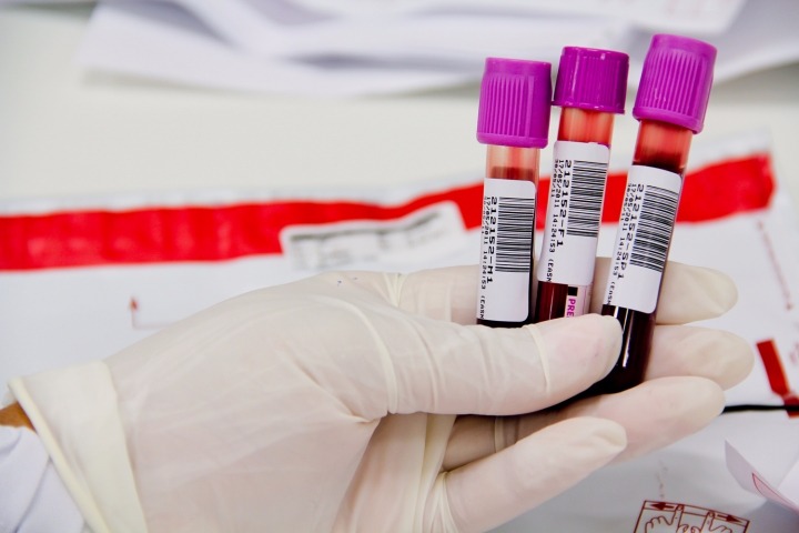 Os resultados dos exames serão disponibilizados na internet.