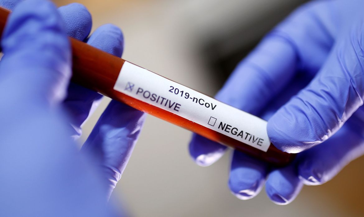 Cientistas desenvolvem medicamento contra novo coronavírus Divulgação / Reuters