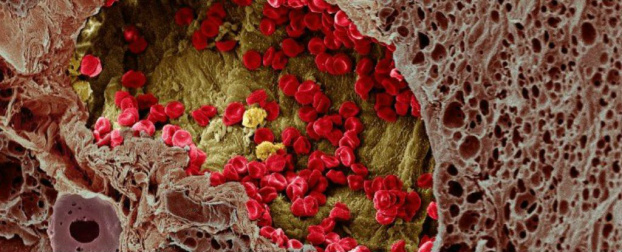 Foto: Reprodução / K. Hodivala-Dilke, M. Stone/Wellcome Images