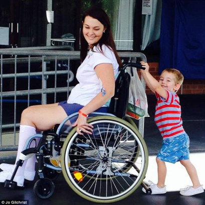Pincel de maquiagem deixa mulher paraplégica Pincel de maquiagem deixa mulher paraplégica