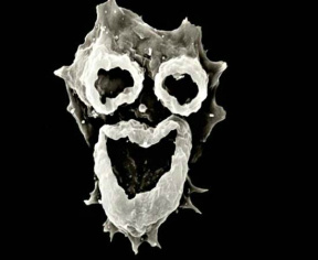 Sua imagem ao microscópio é assustadora, e o que ela faz também.