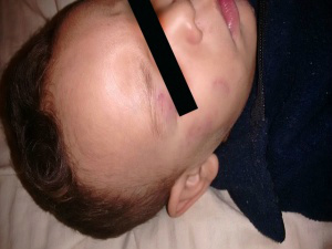 Mãe denuncia creche onde filho foi agredido e mordido pela 4ª vez A criança foi mordida por um colega (Foto: Direto das Ruas, Campo Grande News)
