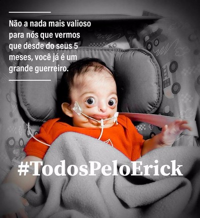 Família pede ajuda para cuidar de bebê que nasceu com malformações múltiplas Foto usada em campanha na internet para ajudar Erick (Foto: Reprodução/Facebook)