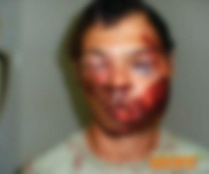 Assaltante ficou machucado após a reação da vítima e reclamava de dores 
(Foto: Gamarra/Rio Brilhante News)