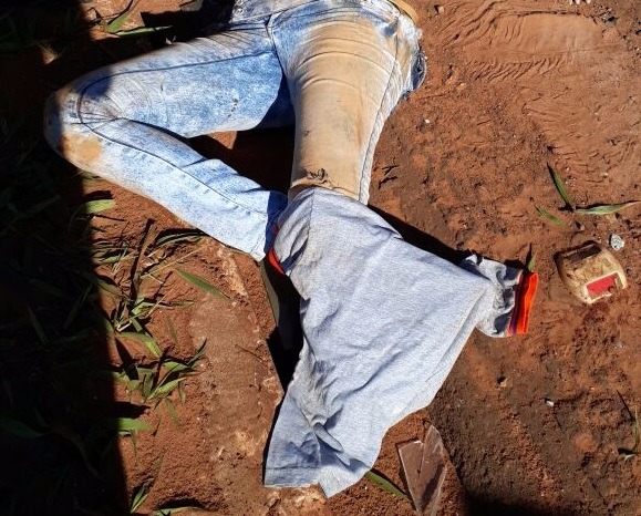 Cabo da PM atropelada por motorista embriagado passa por cirurgia na Santa Casa