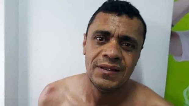 Inquérito desconstrói fake news de facada em Bolsonaro, diz delegado (Reprodução)