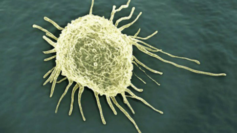 Célula cancerígena: o número de novos casos de câncer cresceu desde 1990