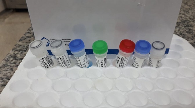 Em caráter emergencial, Saúde inicia compra de 10 mil kits de testes do coronavírus Em caráter emergencial, Saúde inicia compra de 10 mil kits de testes do coronavírus