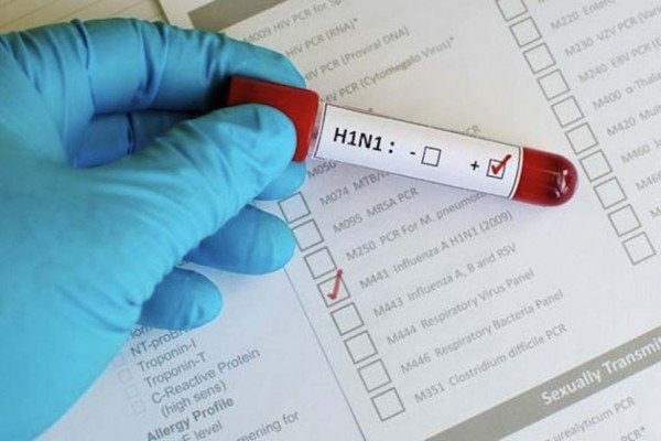 Após quase dois meses, MS volta registrar mortes por gripe Após quase dois meses, MS volta registrar mortes por gripe
