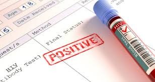 HIV não é sinônimo de aids e tratamento pode garantir vida normal a pacientes