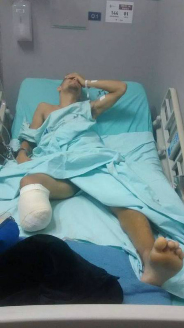 Rapaz ajudado por Madonna é baleado no Complexo da Penha Edeson teve a perna amputada Foto: Reprodução do Facebook