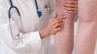 Estimativas dão conta de que, no Brasil, acontecem aproximadamente 400 mil casos ao ano - Crédito: Divulgação
