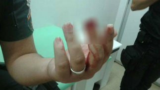 A soldado foi atacada a mordida Foto: TVI Canal 21 / Reprodução