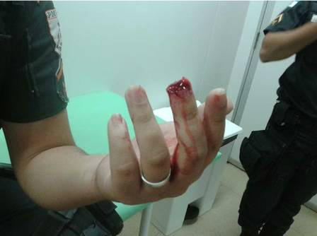 A agente passou por uma cirurgia Foto: TVI Canal 21 / Reprodução