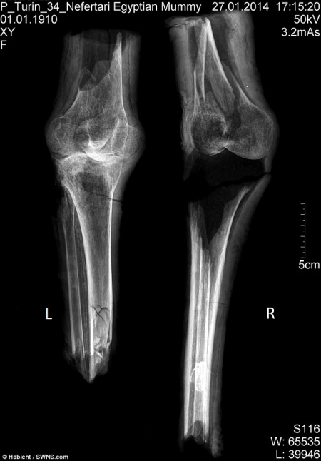 Membros mumificados encontrados podem pertencer à Nefertari, esposa de Ramsés, o Grande Membros mumificados encontrados podem pertencer à Nefertari, esposa de Ramsés, o Grande