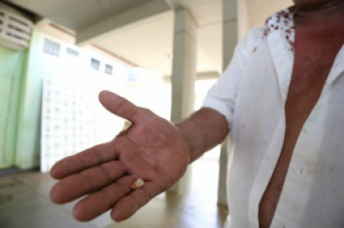 Comerciante mostra dente perdido por causa das severas agressões que sofreu. (Foto: Marcelo Victor)