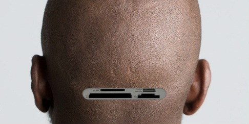 Implante está sendo desenvolvido para aumentar a capacidade de memória Implante está sendo desenvolvido para aumentar a capacidade de memória