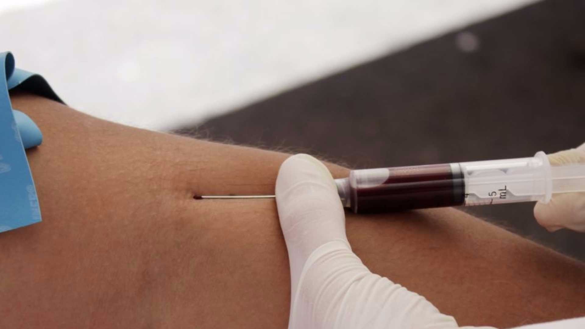 18,4 milhões têm problema de colesterol alto no Brasil Reprodução/Lusa