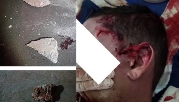 Homem tem traumatismo craniano ao ser agredido por dupla a pedradas no interior Foto: Divulgação